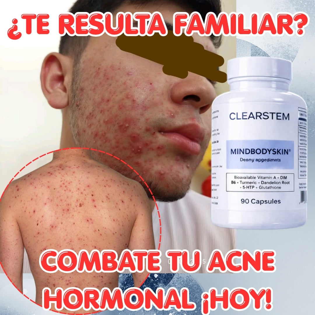 🧬 Piel Nueva 30D: El Borrador de Acné Hormonal (Limpia desde Adentro)