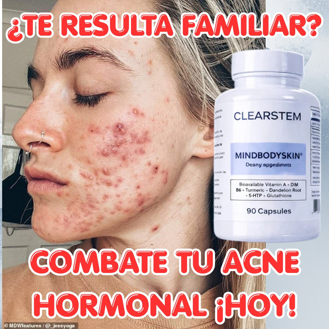 🧬 Piel Nueva 30D: El Borrador de Acné Hormonal (Limpia desde Adentro)