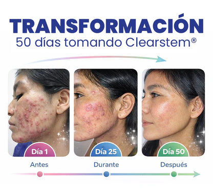 🧬 CAPSULAS CLEARSTEM-Piel de Porcelana en 30 Días: El Borrador de Acné